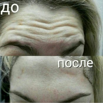 Алла Мамиконян, Moscow Фото - 5