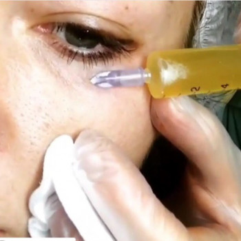 Алла Грекова, Moscow Фото - 5