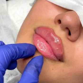 Анна Королькова, Moscow Фото - 5