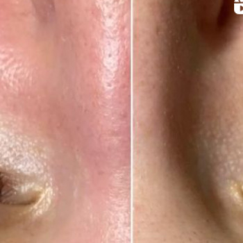 Карине Мнацаканян, Москва Фото - 5