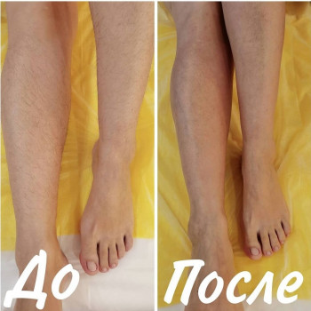 Депиляция сахаром (шугаринг): ноги полностью