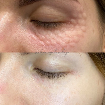 Алина Сергеевна Ряховская, Moscow Фото - 5