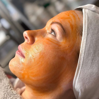 Жёлтый пилинг