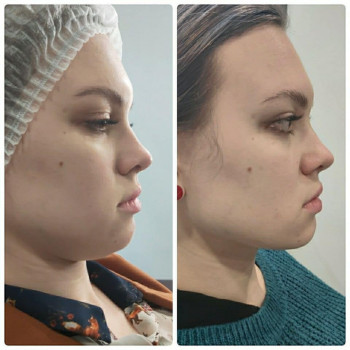 Елена Шаманина, Moscow Фото - 6