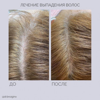 Наталья Николаевна Брезгина, Saint Petersburg Фото - 5