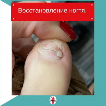 Valgo Podocare, Moscow Фото - 5