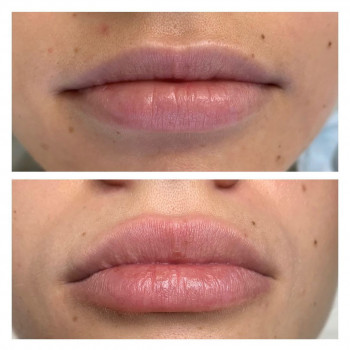 Виолетта Сергеевна Скорич, Moscow Фото - 5