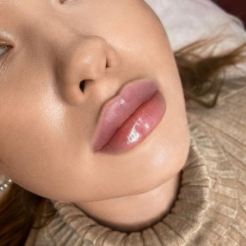 Увеличение губ