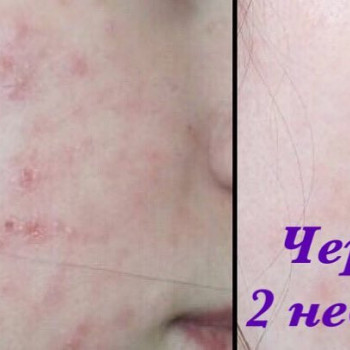 Елена Печенина, Moscow Фото - 5