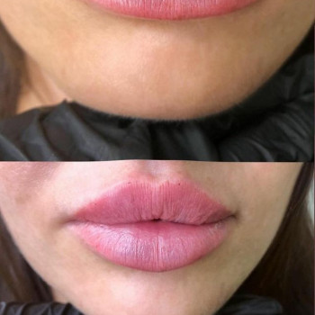 Serebro, Moscow Фото - 6