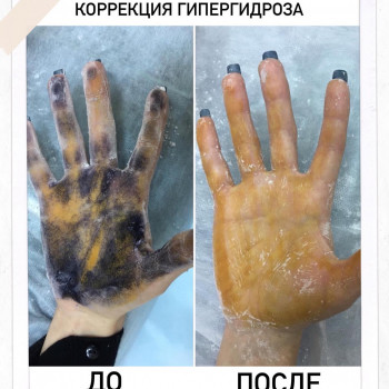 СМ-Пластика, Moscow Фото - 5