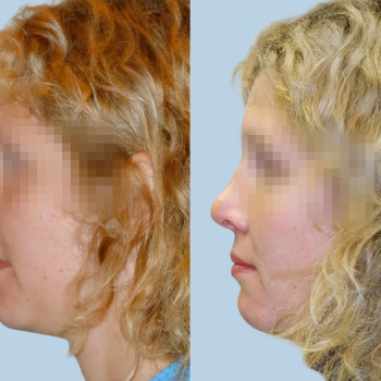 ElleClinic, Moscow Фото - 5