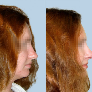 ElleClinic, Moscow Фото - 6