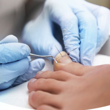 Центр Подологии, Saint Petersburg Фото - 5