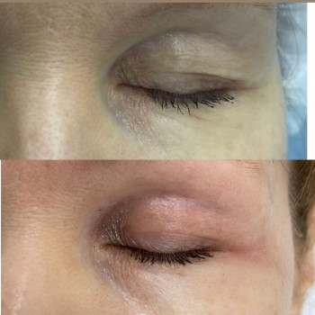 Гаяне Парсегова, Moscow Фото - 5