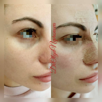 Ольга Непронова, Moscow Фото - 5