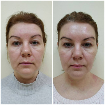 Лейла Роз, Moscow Фото - 5