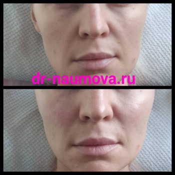 Юлия Наумова, Москва Фото - 5