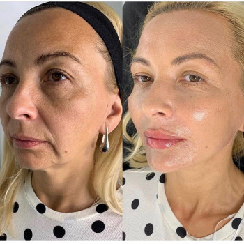 Альбина Аскендерова, Makhachkala Фото - 5