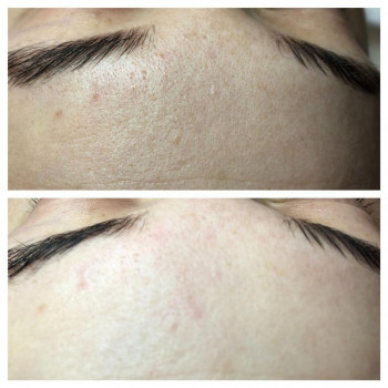 Валентина Нарицина, Saint Petersburg Фото - 5