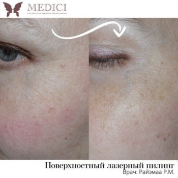 Medici, Saint Petersburg Фото - 6