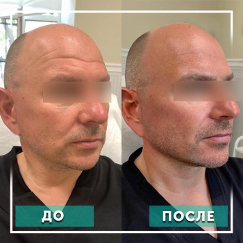 Клиника Пирогова, Saint Petersburg Фото - 5