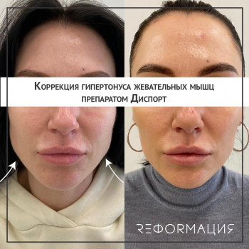 Реформация, Moscow Фото - 5