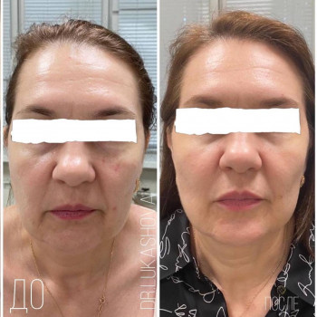 Татьяна Николаевна Лукашова, Moscow Фото - 5