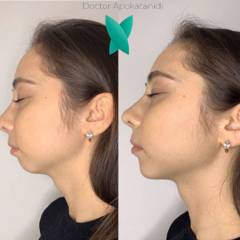 Христина Апокатанди, Moscow Фото - 5