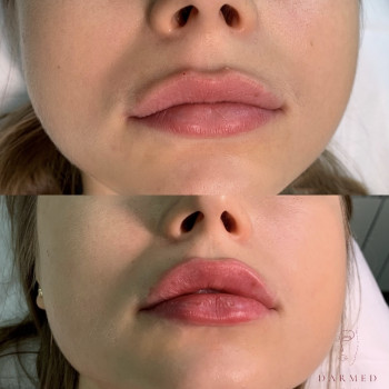 Darmed, Moscow Фото - 5