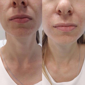 Sneg, Yekaterinburg Фото - 5