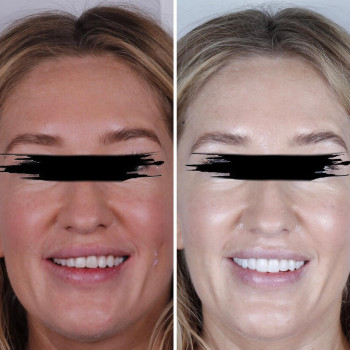 Smile Gallery, Novosibirsk Фото - 5