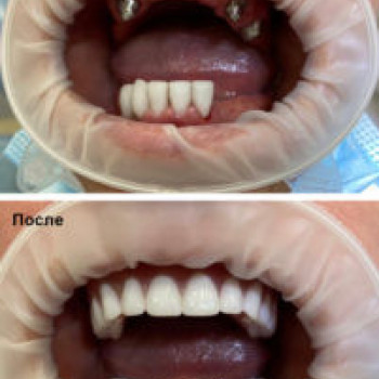 Профидент, Novosibirsk Фото - 5