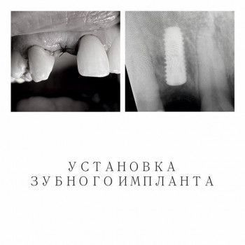 Поэт, Omsk Фото - 5