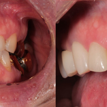 Делюкс Дент, Novosibirsk Фото - 5