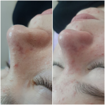 Zefir, Челябинск Фото - 5