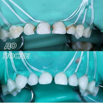 Зубной стандарт, Челябинск Фото - 6