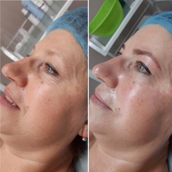 Fibula, Samara Фото - 5