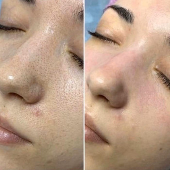 Лакки, Samara Фото - 5