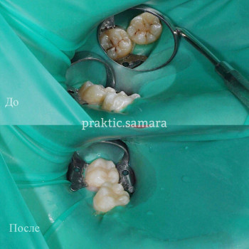 Практик, Samara Фото - 5