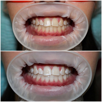 ССК, Samara Фото - 5