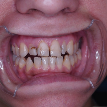 Самарский стоматологический центр №1, Samara Фото - 5