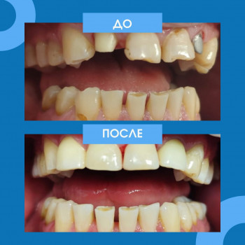 МирДент, Samara Фото - 6