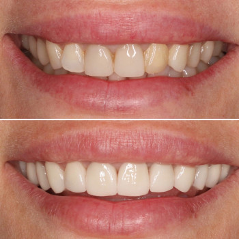 Дентклиник, Samara Фото - 6