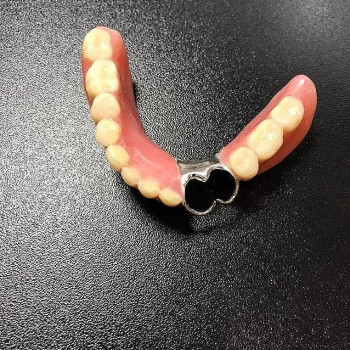 Ала-Дент, Samara Фото - 5