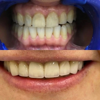 МедиДентЭлит, Krasnoyarsk Фото - 5