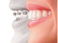 Dental Clinic Без боли on Barb.pro