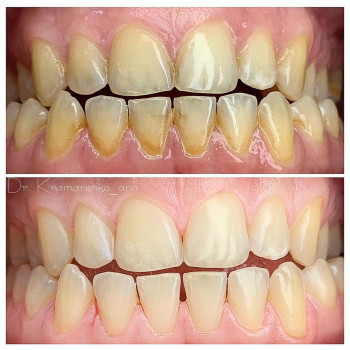 Элла-Стом, Volgograd Фото - 5