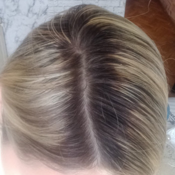 лечение волос