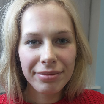 ПОСЛЕ. Мезотерапия.